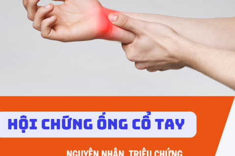 HỘI CHỨNG ỐNG CỔ TAY – NGUYÊN NHÂN, TRIỆU CHỨNG VÀ CÁCH CHĂM SÓC TOÀN DIỆN THEO Y HỌC CỔ TRUYỀN